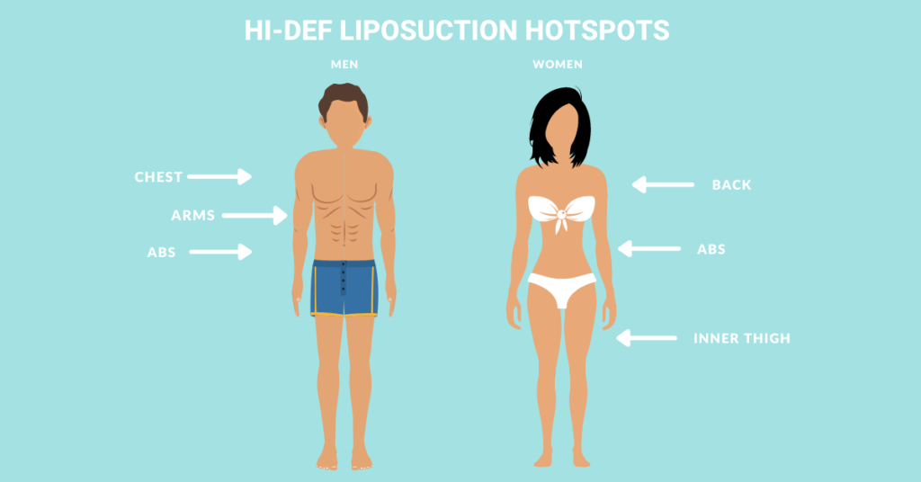 La dernière frontière du remodelage corporel : la liposuccion haute définition