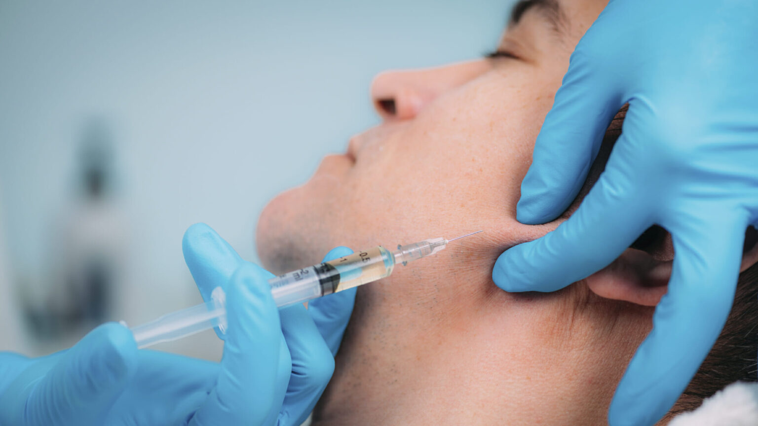 Amélioration de la mâchoire avec des injections de remplissage des tissus mous durables et très satisfaisantes