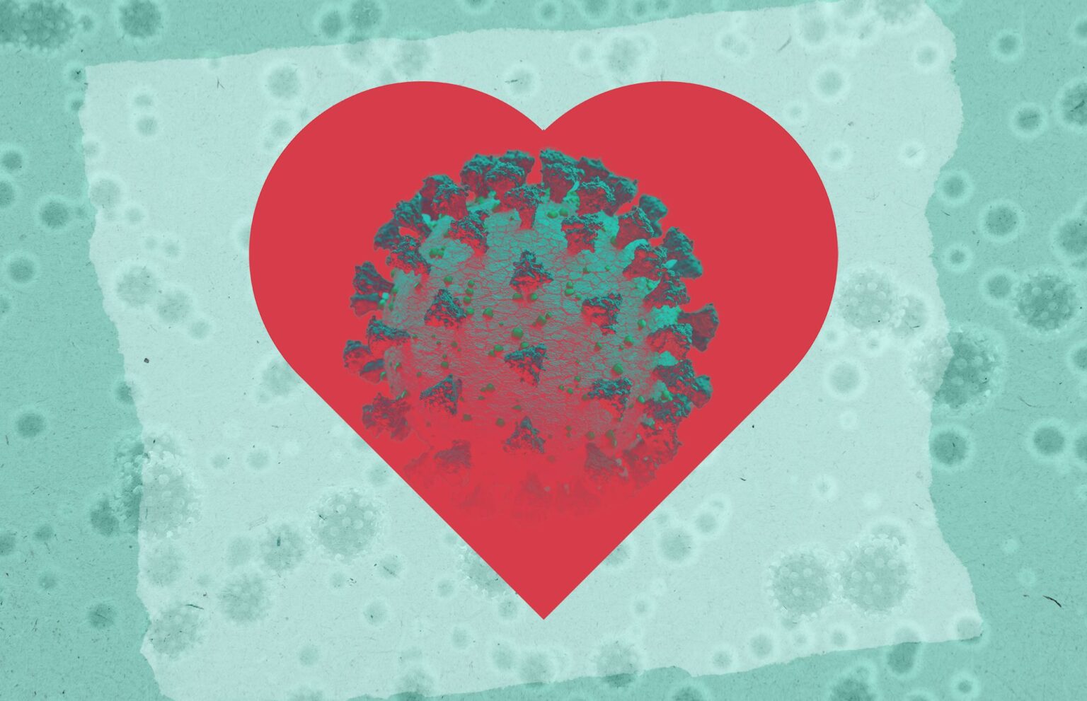 COVID-19 peut augmenter le risque de maladie cardiovasculaire jusqu'à un an plus tard, même après une maladie bénigne