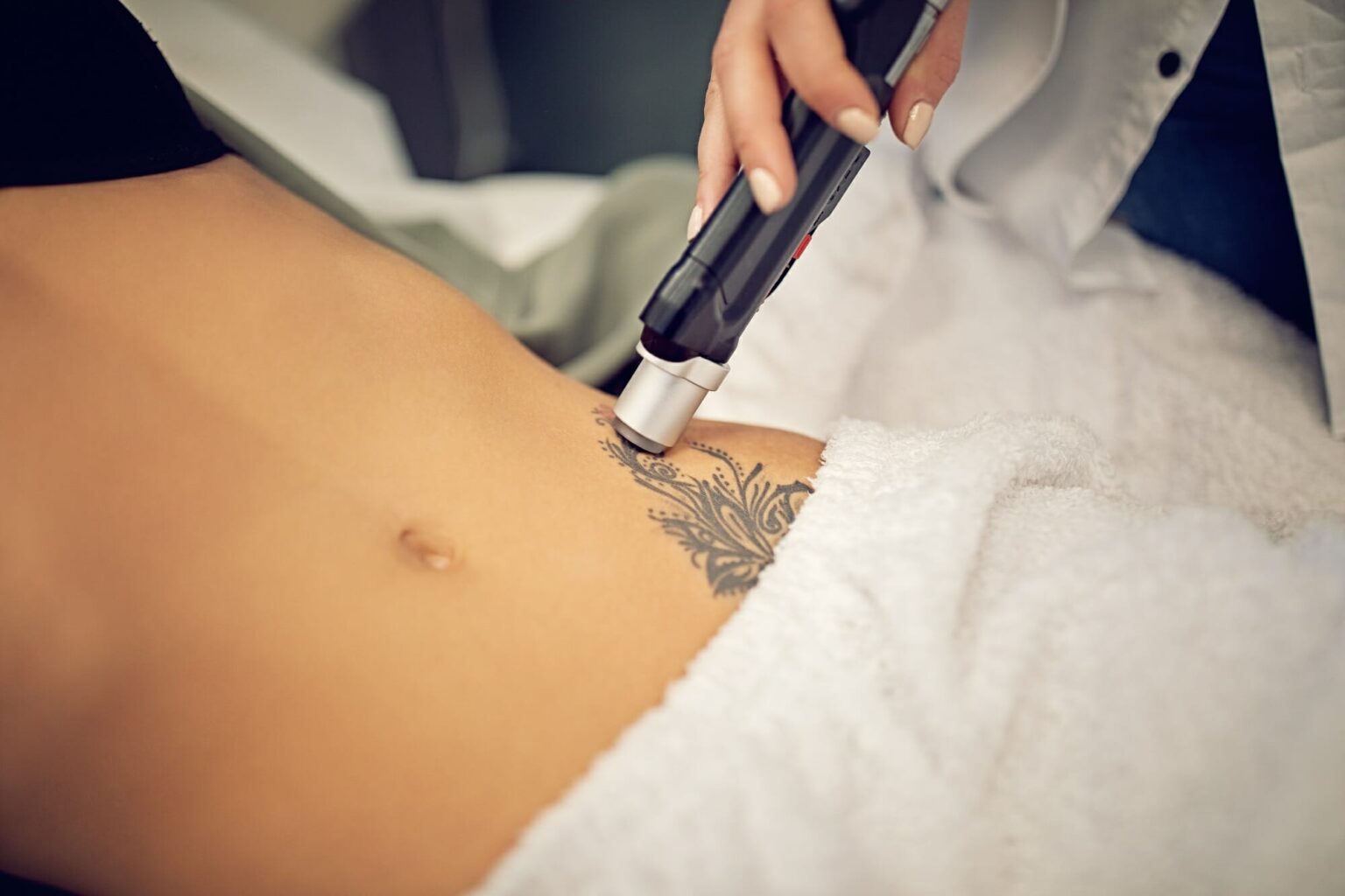 Efficacité comparative de PSL vs NSL pour le détatouage assisté par laser Efficacité comparative de PSL vs NSL pour le détatouage assisté par laser