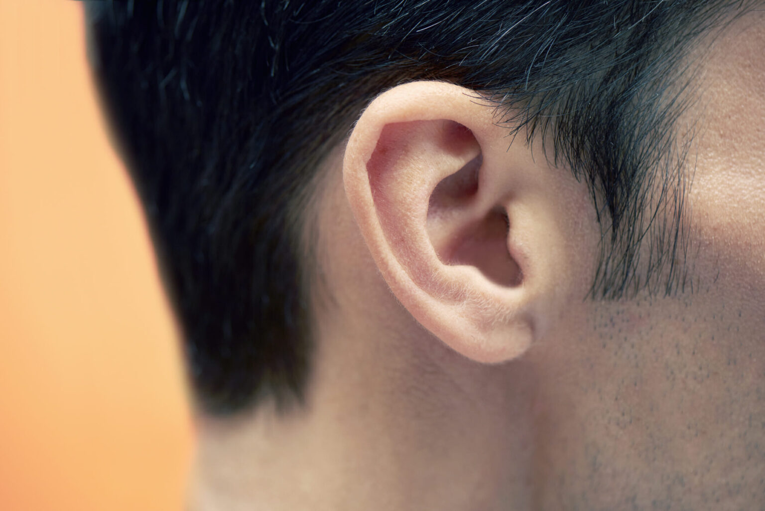 Les combinaisons de traitement au laser montrent des résultats positifs pour les chéloïdes auriculaires