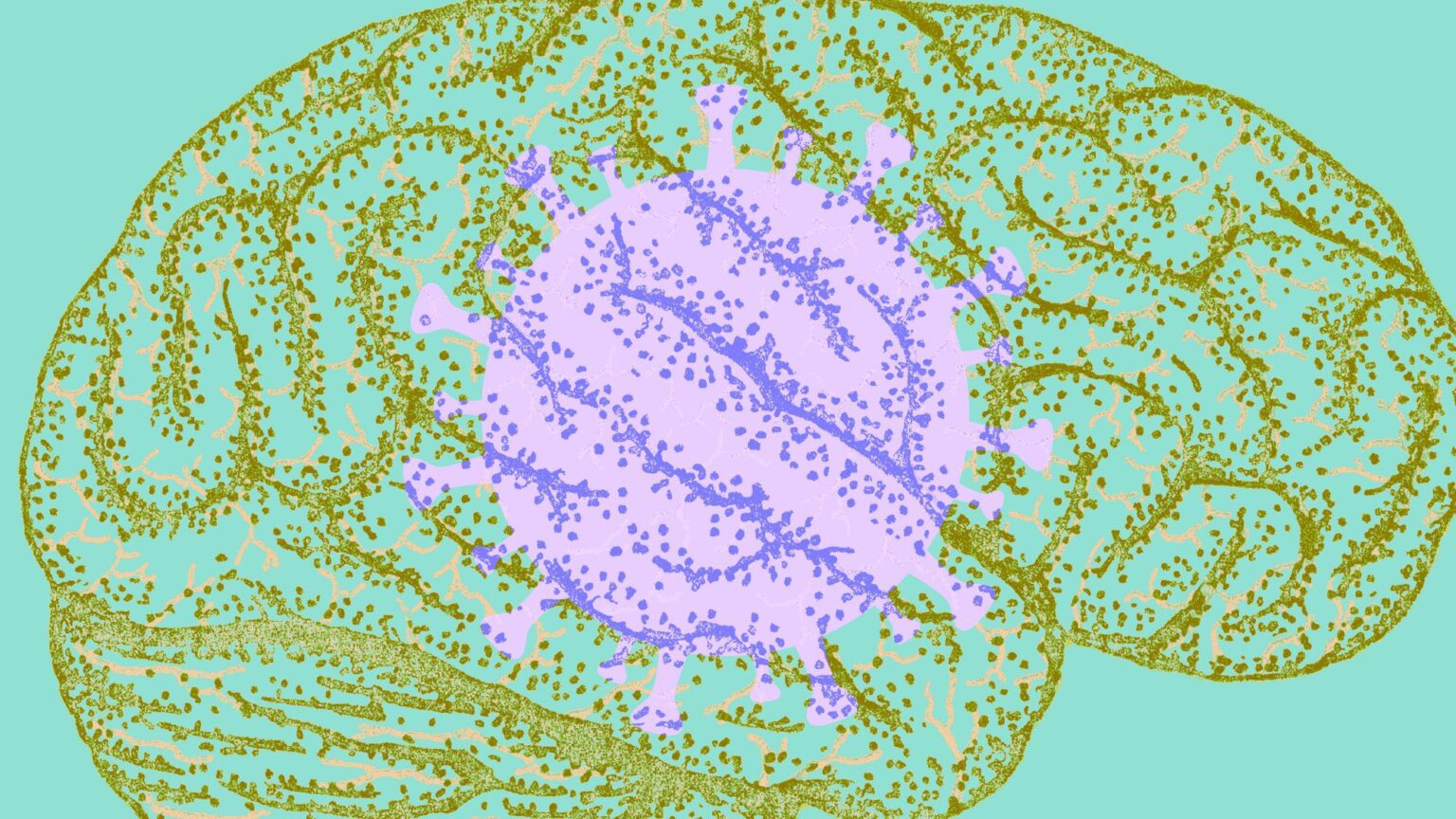 Même une COVID-19 légère peut entraîner des problèmes de santé mentale à long terme