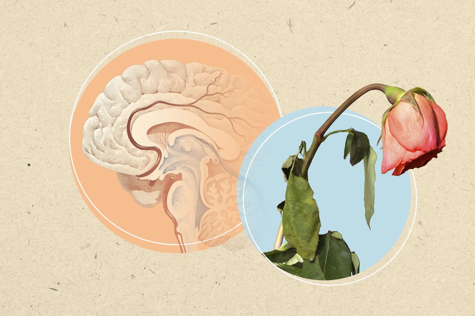 Passer par la ménopause avant l'âge de 45 ans pourrait augmenter le risque de démence plus tard