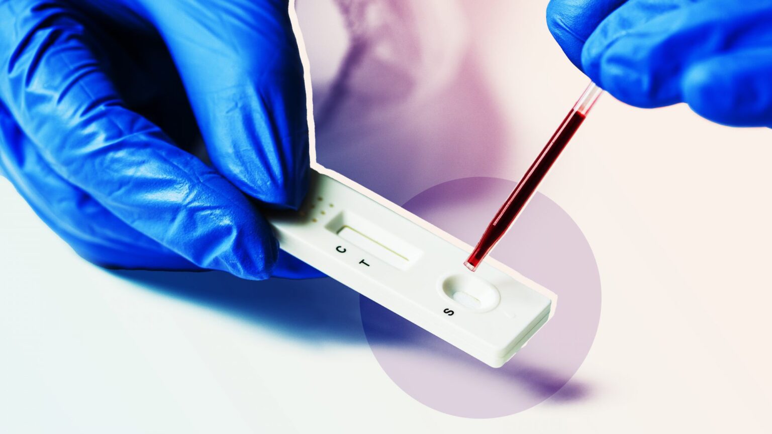 Qui devrait obtenir un test d'anticorps pour COVID-19 ?  Voici ce que les médecins conseillent