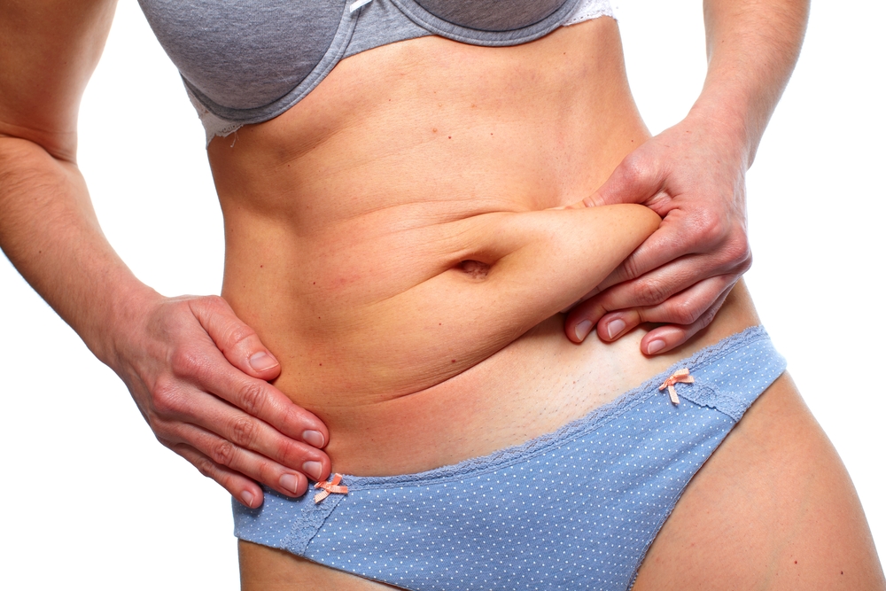Différentes techniques de plastie abdominale