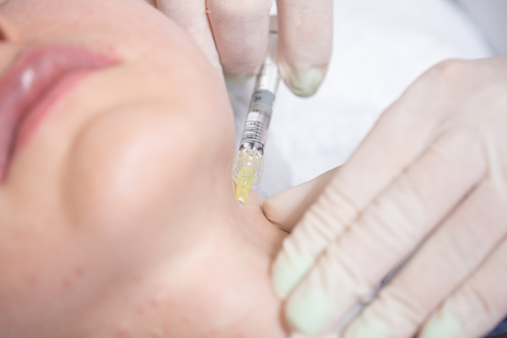 Kybella peu invasive peut améliorer votre décolleté Kybella peu invasive peut améliorer votre décolleté