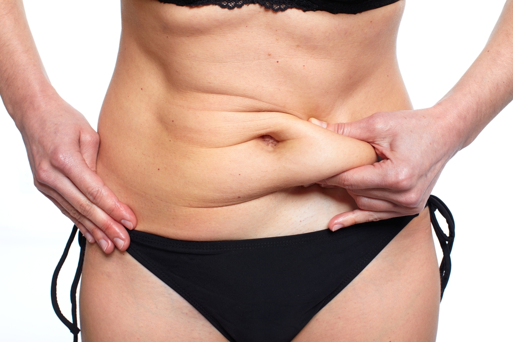 Quelle abdominoplastie me convient?