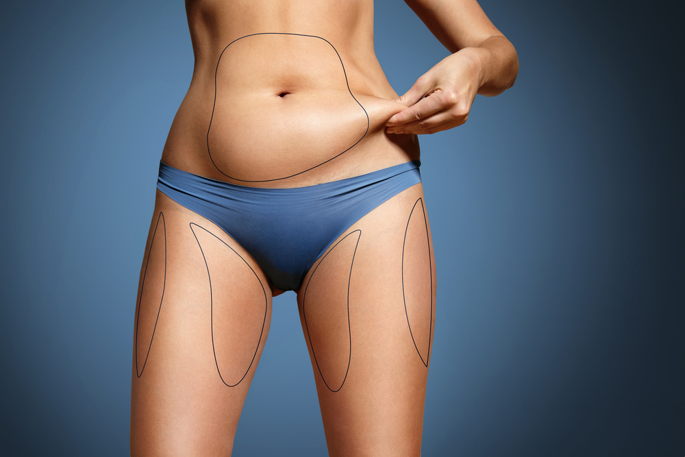 Le maigre sur CoolSculpting Le maigre sur CoolSculpting