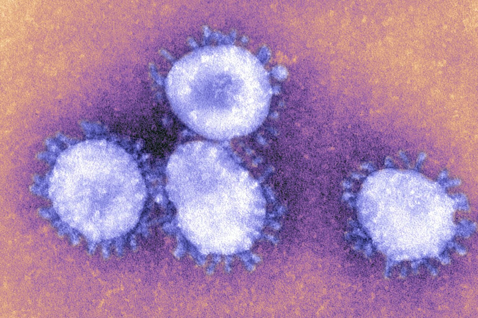 Combien de personnes sont mortes du coronavirus ?  Voici ce que disent les dernières données américaines