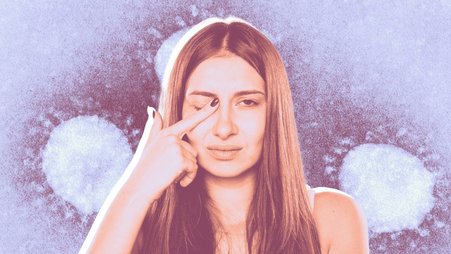 L'œil rose est-il un symptôme du coronavirus ?  Les ophtalmologistes disent que la conjonctivite pourrait être un signe précoce rare