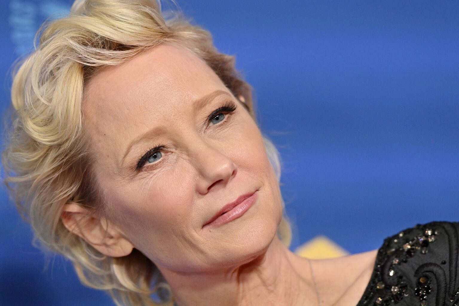 Qu'est-ce qu'une lésion cérébrale anoxique ?  Anne Heche déclarée en état de mort cérébrale après un accident de voiture
