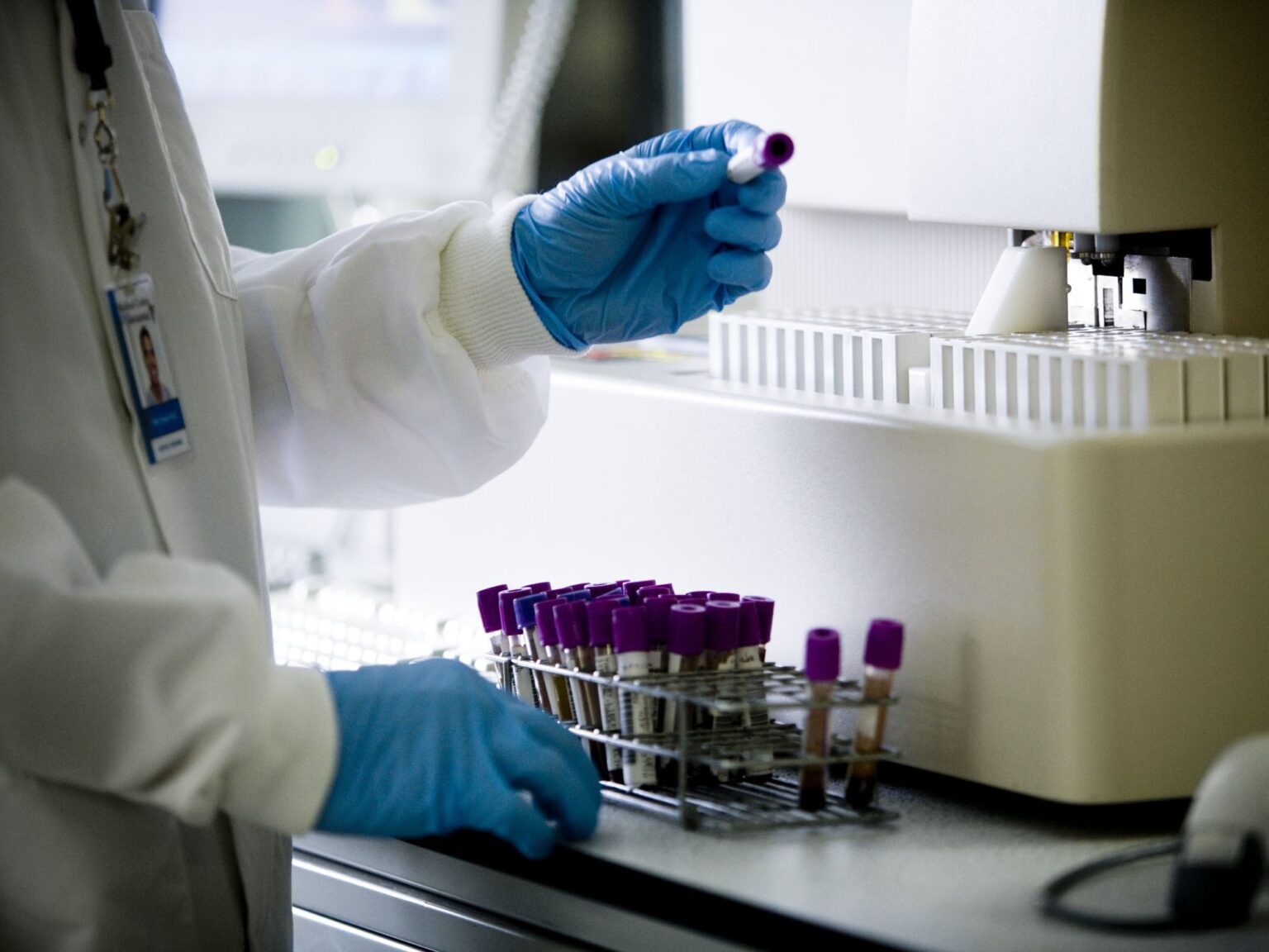 La thérapie CAR T-Cell aide les patients atteints de lupus à entrer en rémission dans une petite étude La thérapie CAR T-Cell aide les patients atteints de lupus à entrer en rémission dans une petite étude