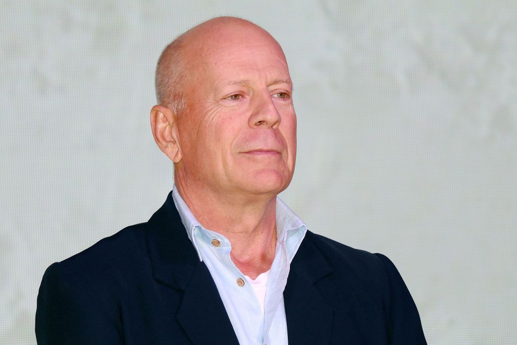 Comment diagnostique-t-on la démence frontotemporale ? L’état de Bruce Willis, expliqué Comment diagnostique-t-on la démence frontotemporale ? L'état de Bruce Willis, expliqué