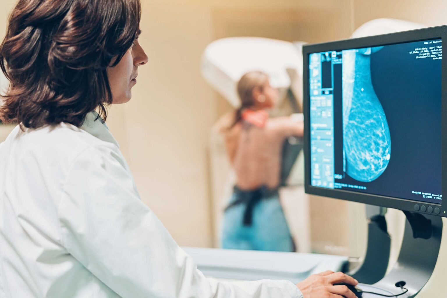Les IRM peuvent mieux détecter le cancer dans les seins denses que les mammographies - devriez-vous en obtenir un ?