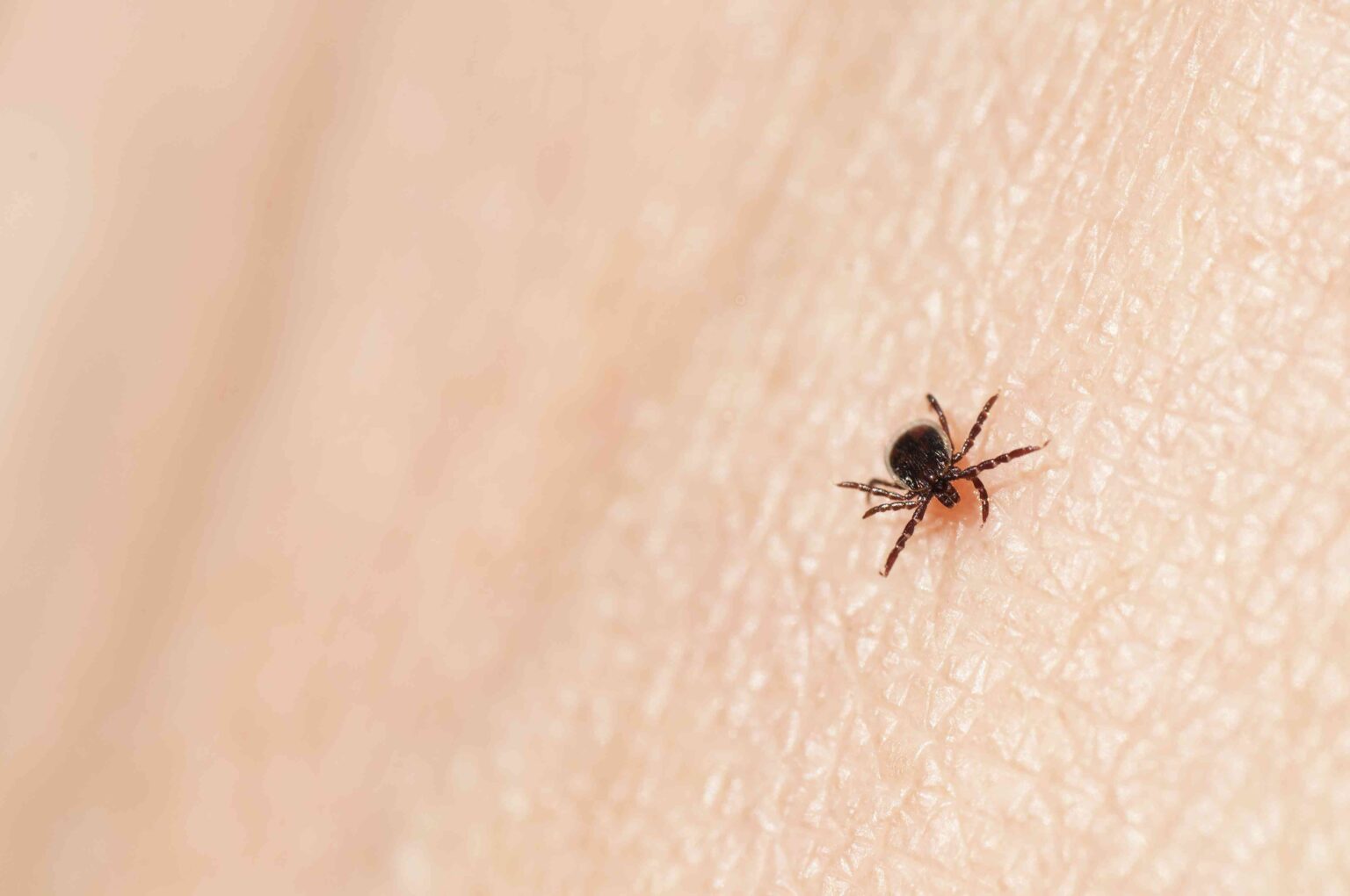 Qu'est-ce que la babésiose?  Maladie transmise par les tiques en hausse dans le nord-est, selon le CDC