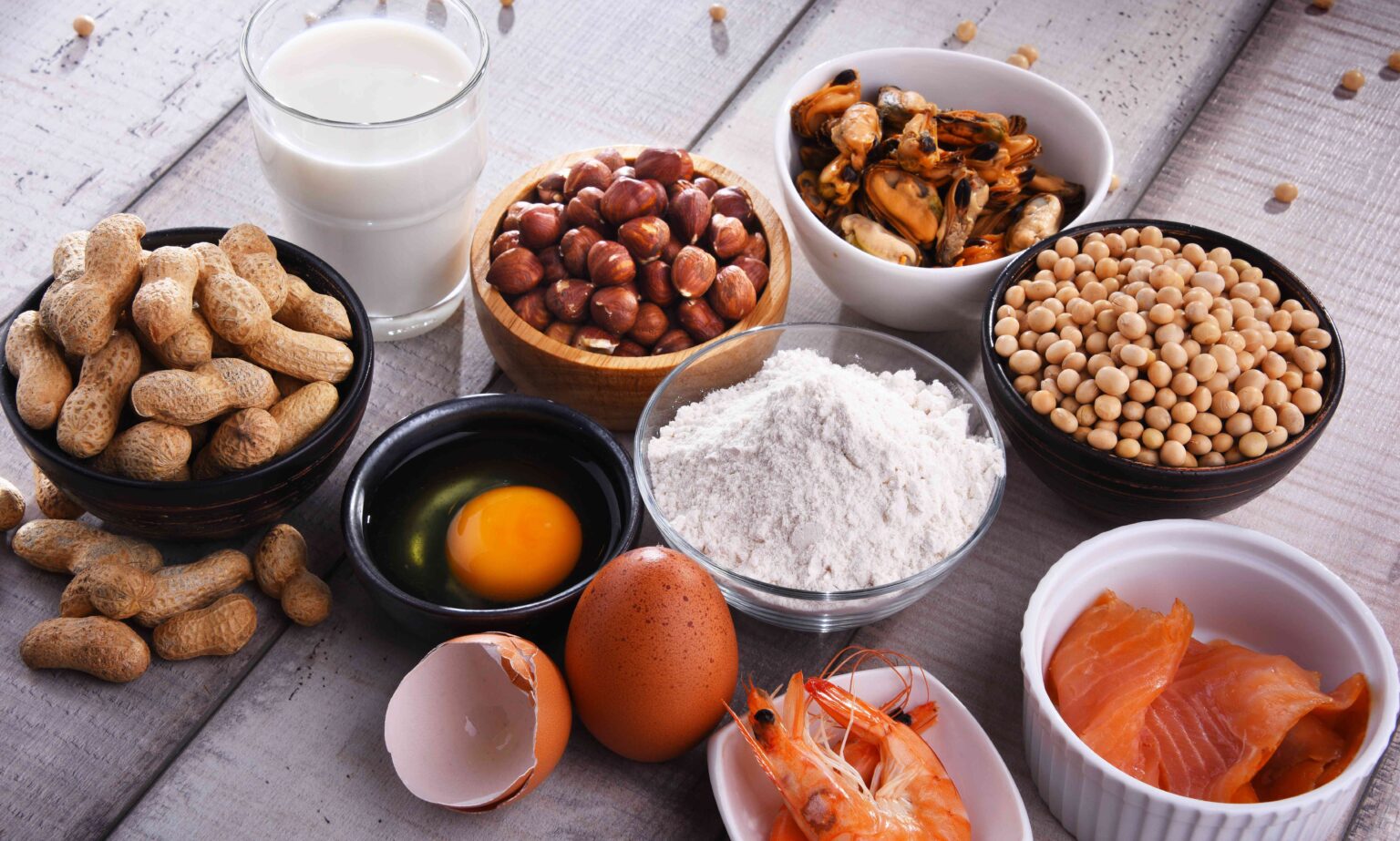 Les personnes de couleur sont plus susceptibles d’avoir des allergies alimentaires que les personnes de race blanche, selon une étude Les personnes de couleur sont plus susceptibles d'avoir des allergies alimentaires que les personnes de race blanche, selon une étude