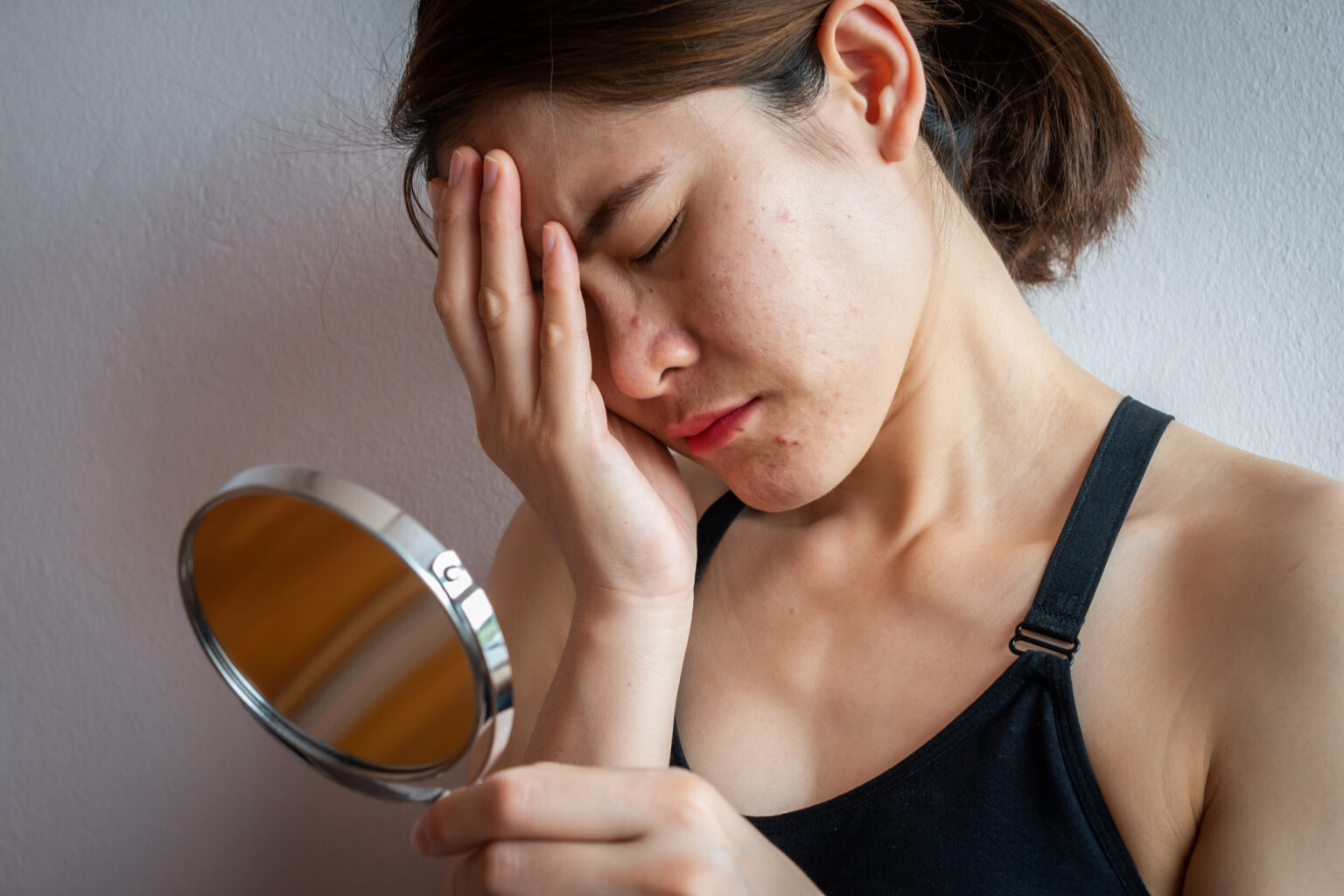 Comprendre l’impact du psoriasis pustuleux généralisé sur la qualité de vie Woman looking in mirror upset