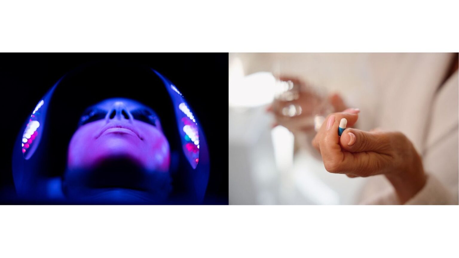 Mise à jour des lignes directrices AAD : photothérapie et thérapie systémique chez les adultes atteints de dermatite atopique phototherapy-left-pill-right