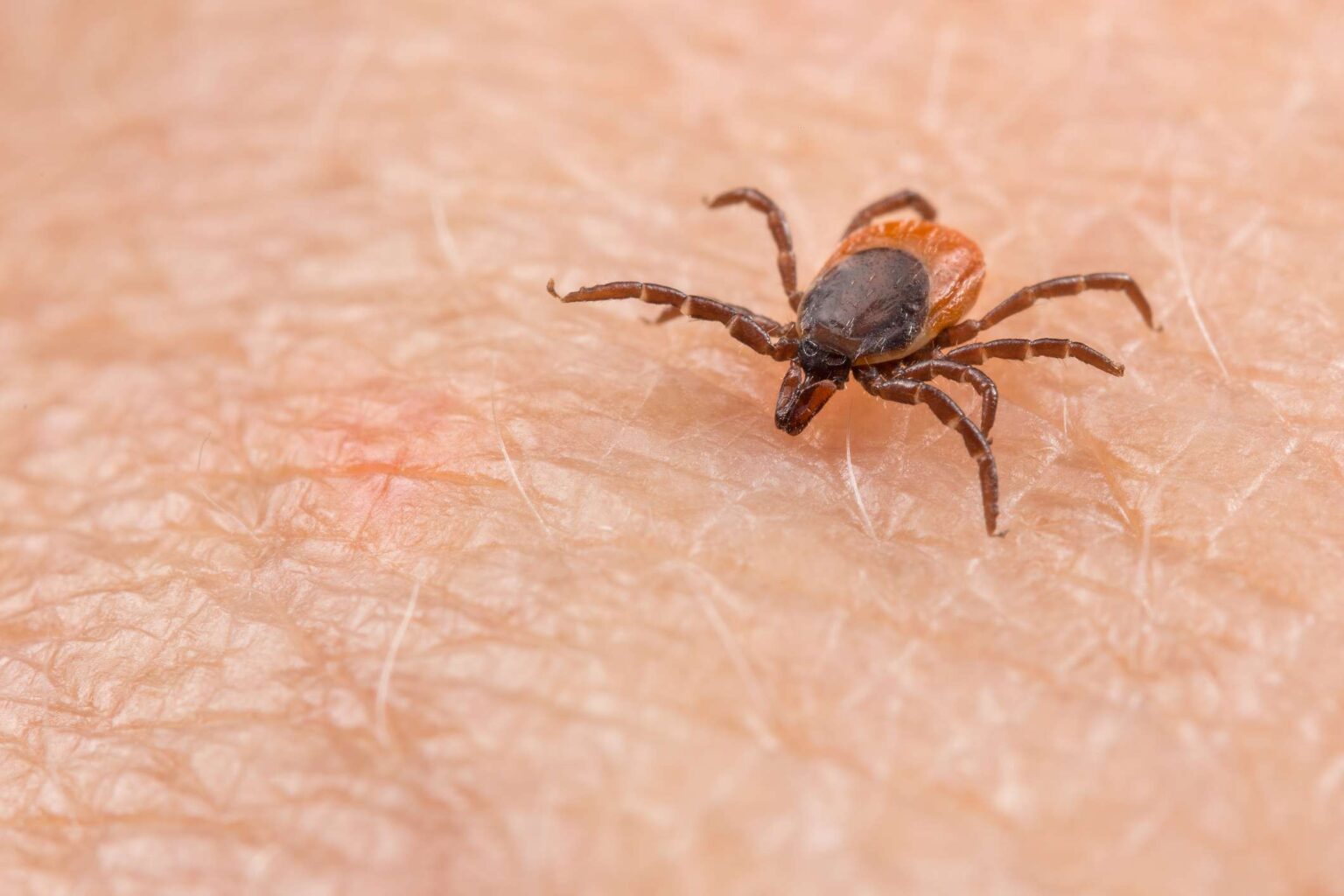 Qu’est-ce que la fièvre pourprée des montagnes Rocheuses ? Le CDC publie une nouvelle alerte sanitaire Qu’est-ce que la fièvre pourprée des montagnes Rocheuses ? Le CDC publie une nouvelle alerte sanitaire